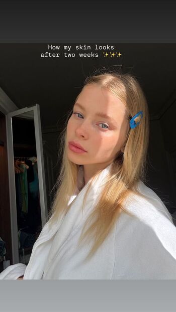 🔥 Alla bruletova page leaked private photo uncensored full