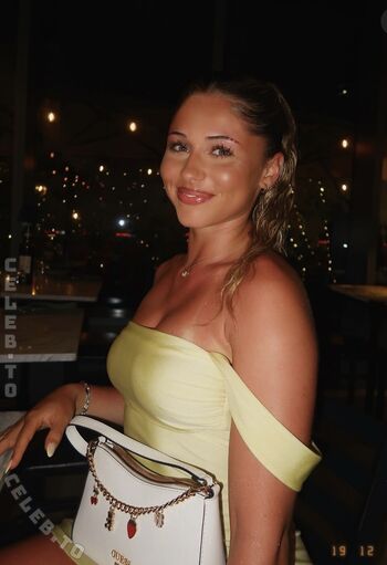 🔥 Alysa ruppert  page leaked private photo uncensored full