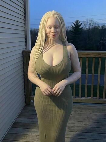 🔥 Lightskin  page leaked private photo uncensored full