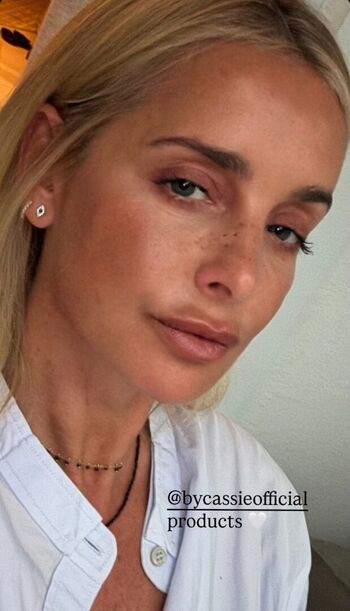 🔥 Louise redknapp leaked private photo uncensored full