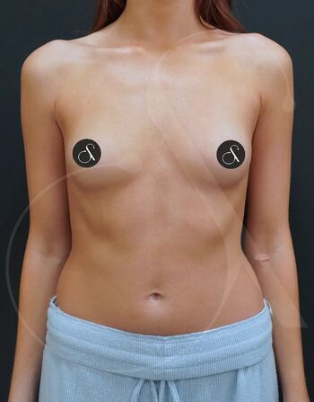 🔥 Miafemtech leaked private photo uncensored full