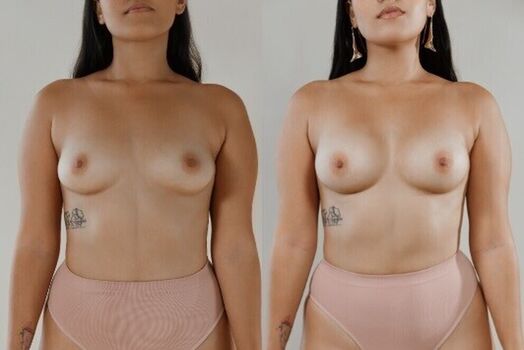 🔥 Miafemtech leaked private photo uncensored full