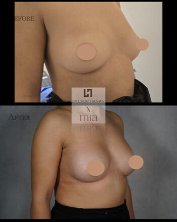 🔥 Miafemtech leaked private photo uncensored full