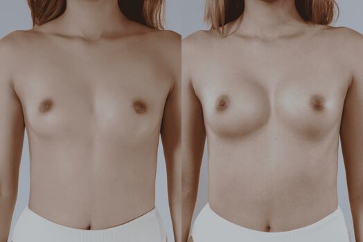 🔥 Miafemtech leaked private photo uncensored full