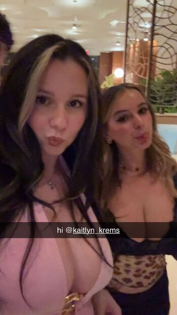 🔥 Yellz  page leaked private photo uncensored full